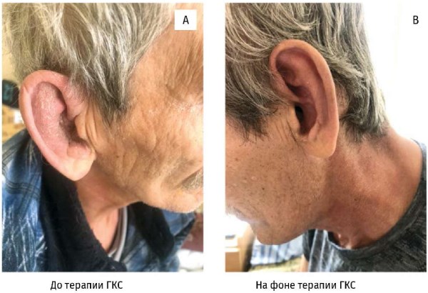 Изображение на обложке